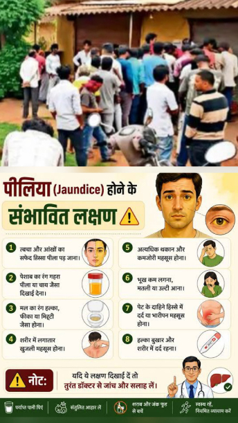 बस्तर में पीलिया का प्रकाेप, देसी इलाज के लिए मरीजों की लगी कतार